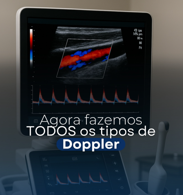 Doppler vascular no Centro Diagnóstico do Leblon